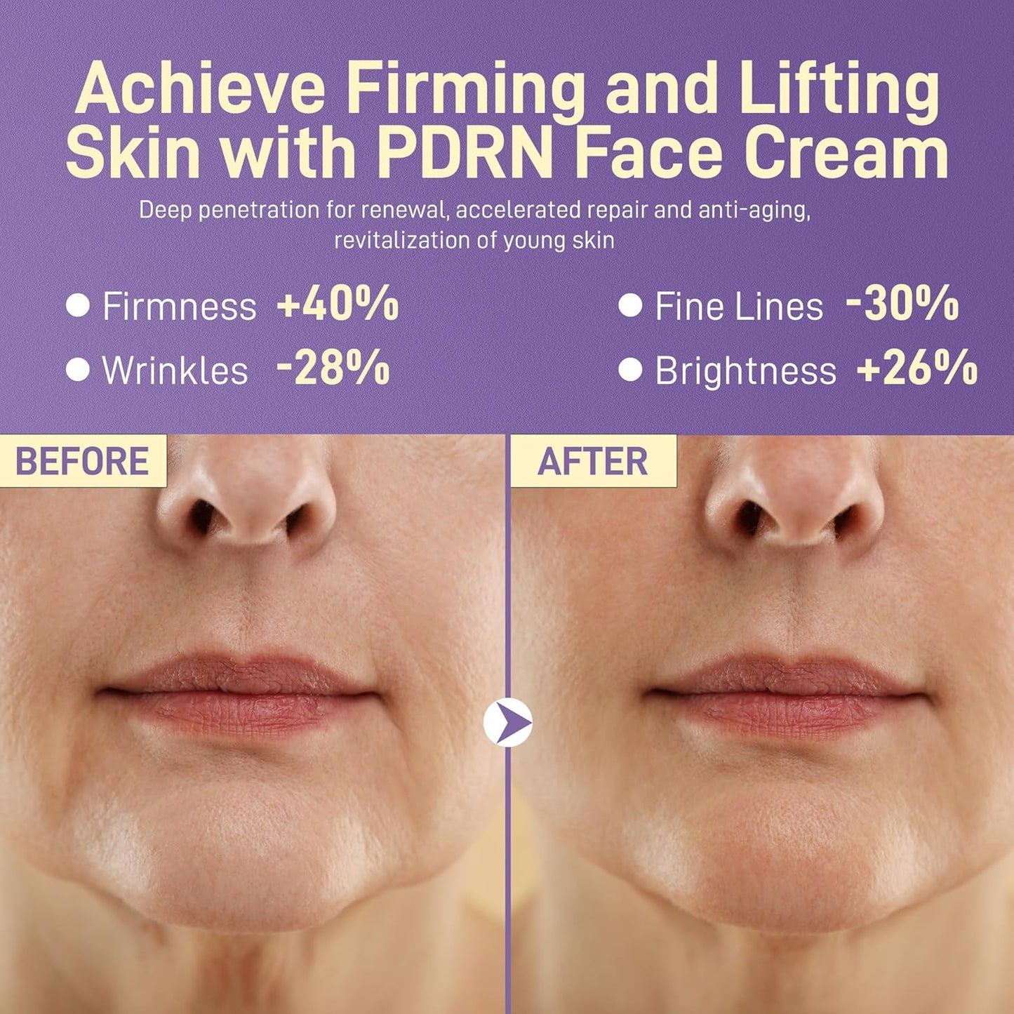 PDRN Anti-Aging Face Moisturizers Cream - 100% Pure PDRN Salmon DNA, 5% Squalane, NAD+, Retinol & Collagen, Firming, Hydrating, Soothing Repair Face & Neck Skinare for All Skin Types,1.85 Fl Oz