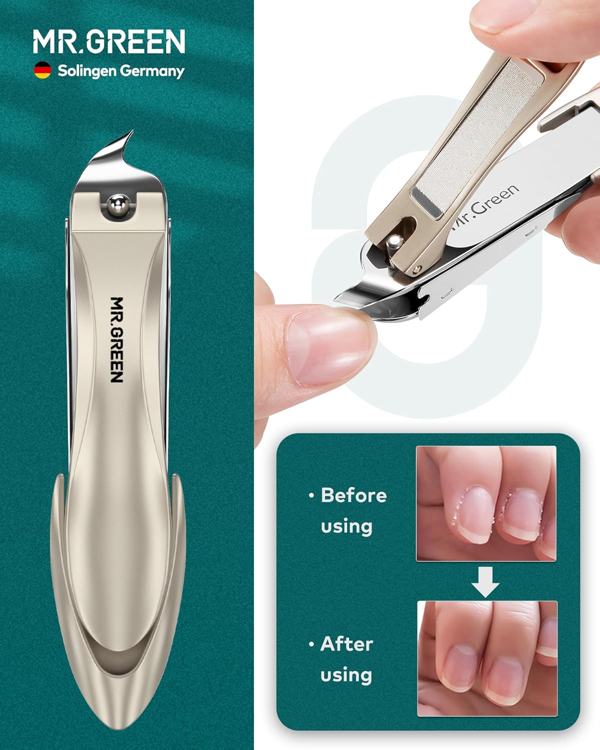 MR.GREEN Upgraded Manicure Set, German Stainless Nail Clippers Set w/Anti Splash Cather, Quality Fingernail& Toenail Clipper, Professional Nail Care Kit with Exquisite Leather Case for Men&Women